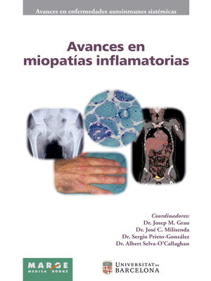 cover image of Avances en miopatías inflamatorias